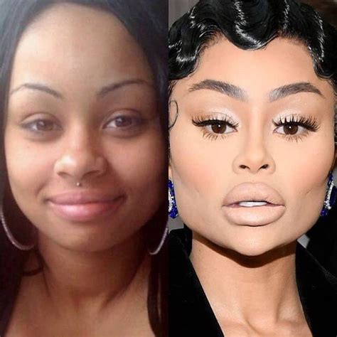 Black Chyna Plastic Surgery Has Dramatically Changed Her Face Much Like