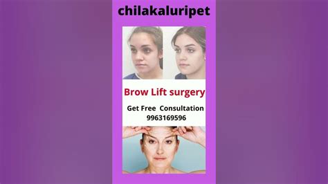 Brow Lift Surgery Cost In Chilakaluripet Brow Lift Treatment In