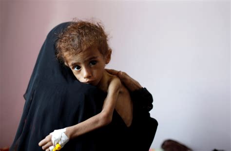 Fighting Starvation And Disease Yield Grim Crisis In Yemen Pbs Newshour