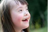 Los individuos con síndrome de down poseen 3 cromosomas en el par 21, en lugar de los 3 que habitualmente se tienen. Síndrome de Down - familydoctor.org