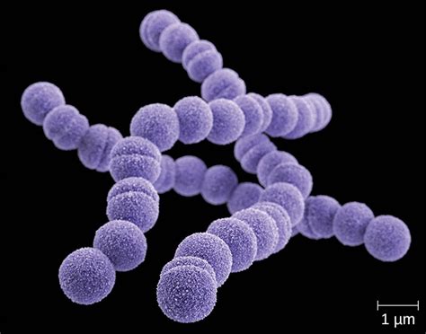 Bacterial Infections Of The Respiratory Tract Microbiology