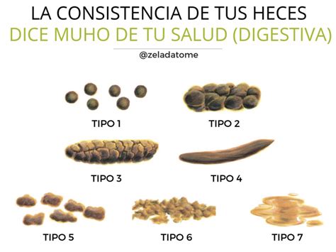 Escala De Bristol Tipo 1