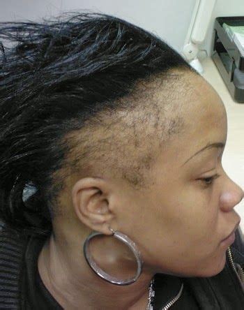 Hair experts explain the anatomy of the hair on our head, offer insight into the damage too much styling can how long your hair is depends on how long your growing cycle lasts. Pin on Blog Posts