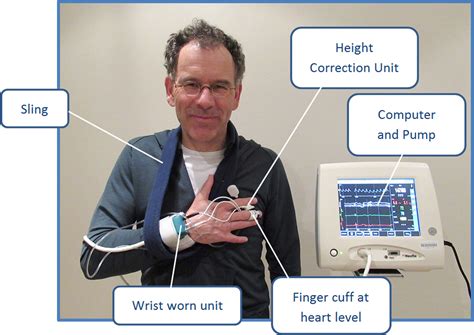 Noninvasive Beat‐to‐beat Finger Arterial Pressure Monitoring During
