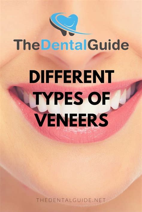 Different Types Of Veneers The Dental Guide