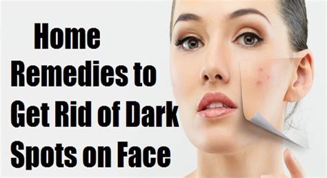 Home Remedies To Get Rid Of Dark Spots From Your Face Just Share The Best