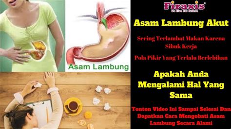 Cara Meredakan Asam Lambung Secara Alami 082264160745 Youtube