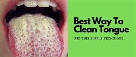 Best Way To Clean Your Tongue 1 Solution That Guarantees To Work Teethmastery