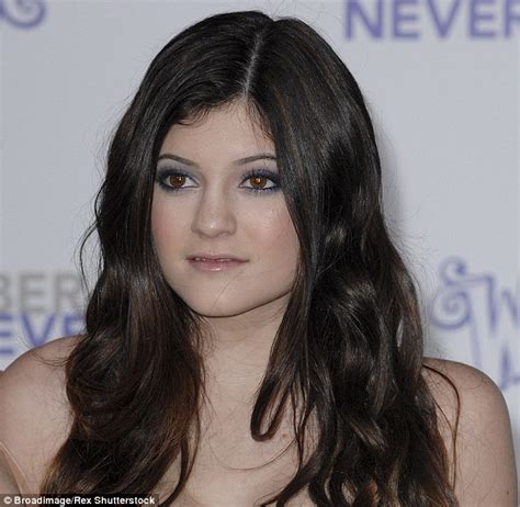 Kylie Jenner Praises Surgeon Who Injects Her With Super Natural Lip