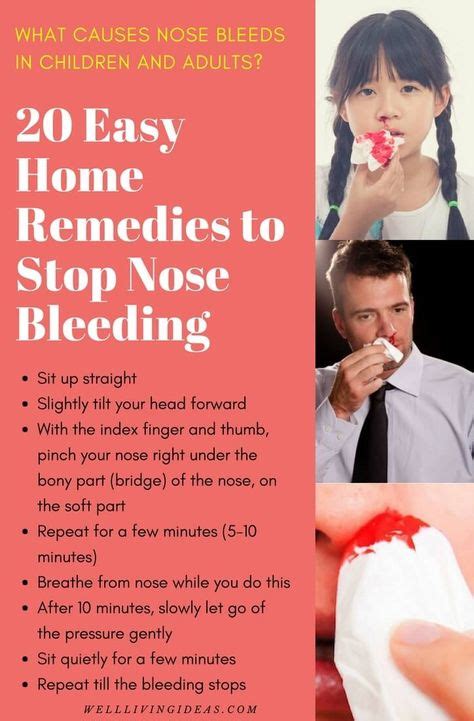 20 Easy Home Remedies To Stop Nose Bleeding In Children And Adults Fast
