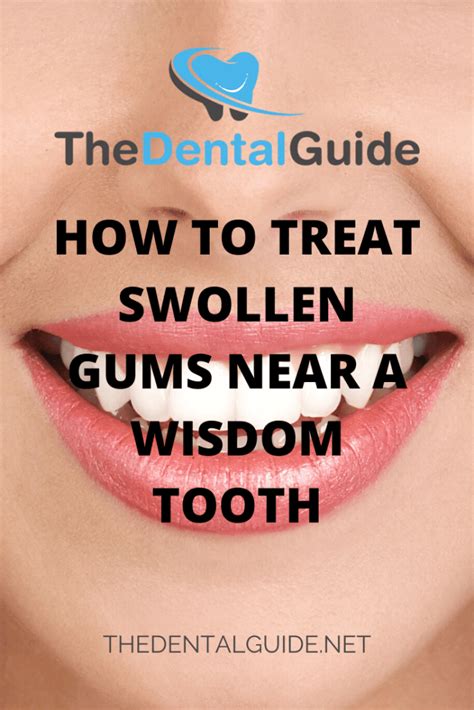 How To Treat Swollen Gums Near A Wisdom Tooth The Dental Guide