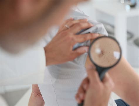 How Does A Skin Cancer Screenings Work Prizant Dermatology