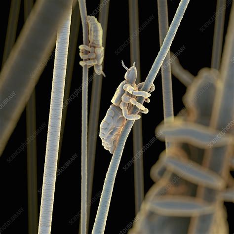 Head Lice Artwork Stock Image C0204439 Science Photo Library