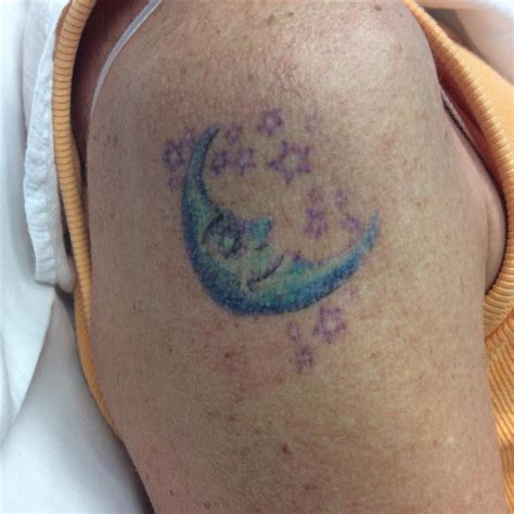Maybe you would like to learn more about one of these? What to Know About Color Tattoo Removal | Removery