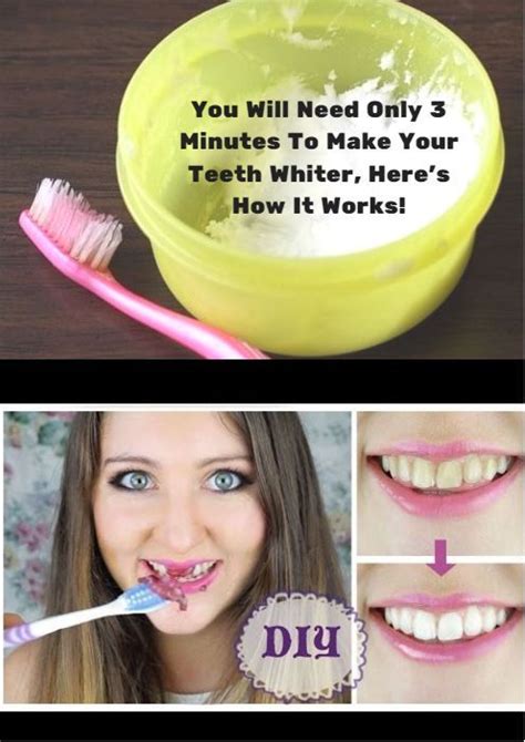 You Will Need Only 3 Minutes To Make Your Teeth Whiter Heres How It