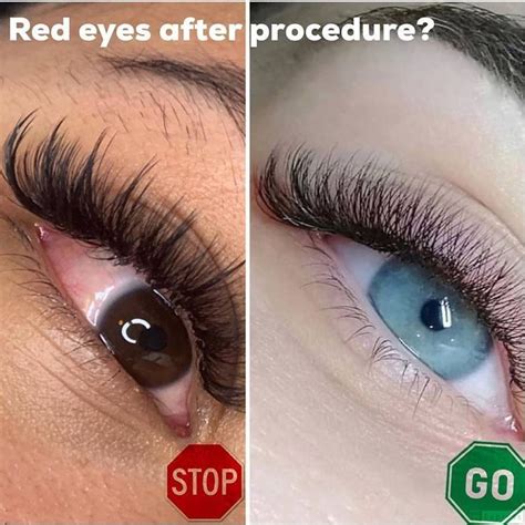 If you're considering eyelash extensions, it will be useful to know exactly how long they'll stick around. Do your clients often have red eyes after the lash ...
