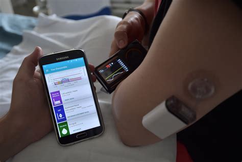 Diabetes Breakthrough As First ‘artificial Pancreas Goes On Sale This