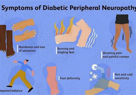 Peripheral Neuropathy Medizzy