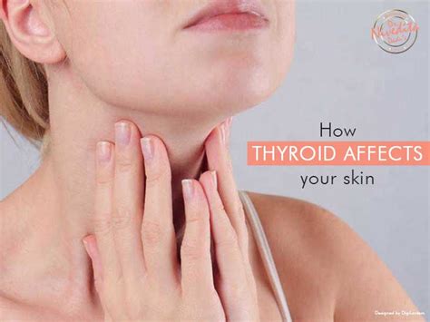 Effects Of Thyroid On Skin Dry Skin Madarosis Hair Loss Face
