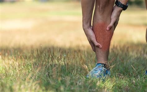 How To Get Rid Of Shin Splints Overnight Great Running Advice