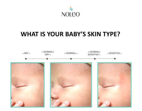 How Newborn And Baby Skin Types Affect Baby Skin Care Noleo
