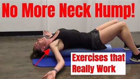 Neck Hump Effective Exercises Posture Exercises Exercise Neck And