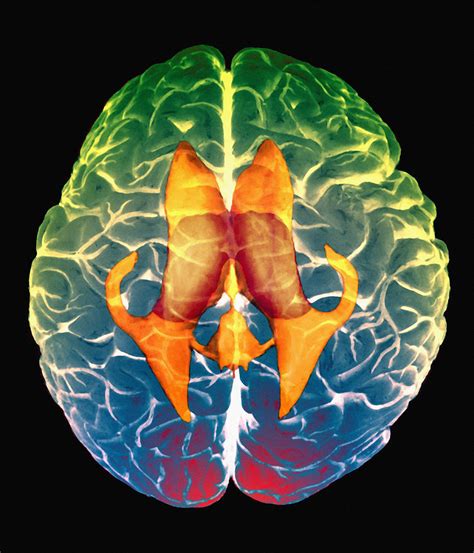 Ventricles Of Brain Photograph By Zephyrscience Photo Library Fine