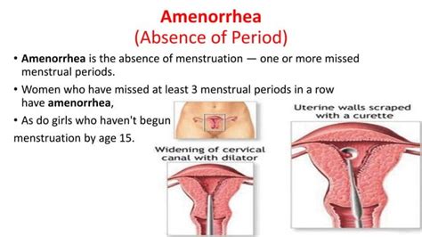 treatment and causes of amenorrhea and diet in amenorrhea