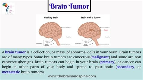 Causes And Treatment For Brain Tumor