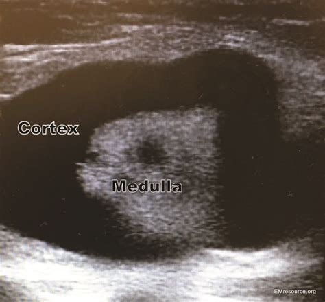 Diagnose This Painful Groin Mass Emergency Physicians Monthly