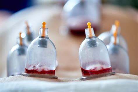 The Sexual Benefits Of Cupping Hejama