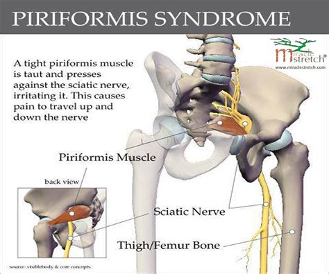 13.04.2020 · 12 photos of the muscles of the lower back and hip diagram. A tight piriformis muscle can compress the sciatic nerve ...