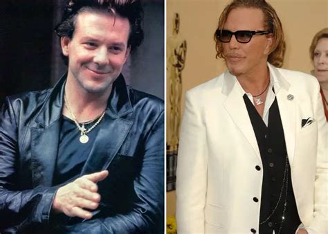 What Happened To Mickey Rourke Plastic Surgery Explained