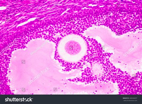 Histology Ovary Under Microscope Stock Photo 468946697 Shutterstock