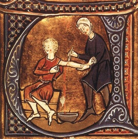 The Most Painful Medical Procedures Of Medieval Times Medieval
