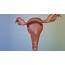 Uterus  3D Model By Medicalgraphicsde TquK7jx
