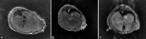 MRI Of MHCC97 L Tumor Bearing Nude Mice A MRI Scanning TI Weight