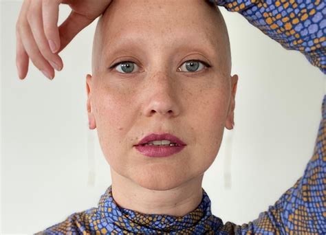 Four Australian Women Reveal What Experiencing Hair Loss Has Taught