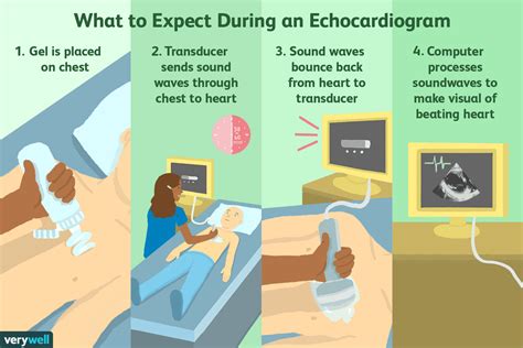 Types Of Echocardiogram Tests And What To Expect