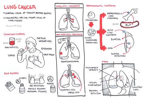 Far less likely once malignant cells have spread. Lung Cancer | Armando Hasudungan