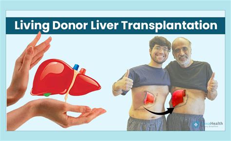 Living Donor Liver Transplant Surgery Procedure Risks And Recovery Time