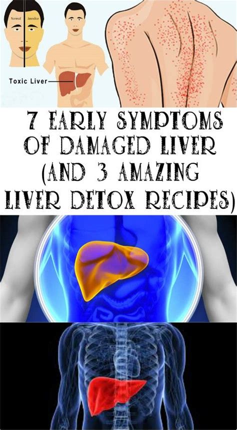7 Early Symptoms Of Damaged Liver And 3 Amazing Liver Detox Recipes
