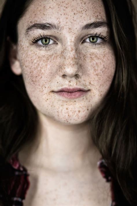Stunning Portraits That Show Just How Beautiful Freckles Are