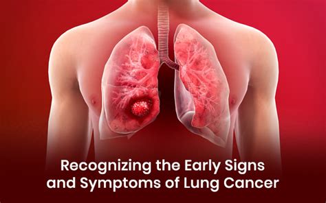 Recognizing The Early Signs And Symptoms Of Lung Cancer