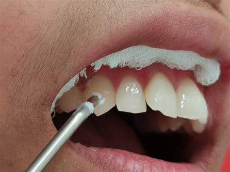 Truth Dental Clinic | Truth About Tooth