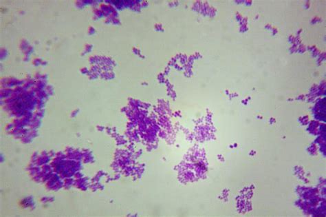 Staphylococcus Aureus Microscope