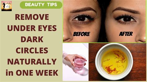 Dip the cloth/ towel into this warm water, take out and squeeze to drain off excess water. REMOVE UNDER EYES DARK CIRCLES NATURALLY in ONE WEEK ...