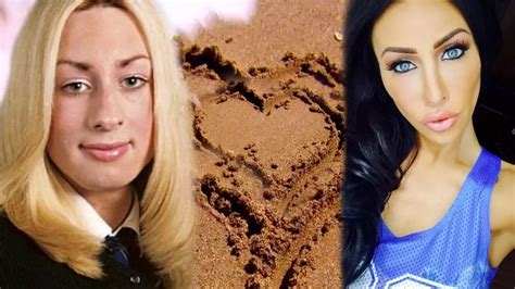 Ex On The Beach Intersex Star Spent £150k On Cosmetic Procedures Before This Years Show