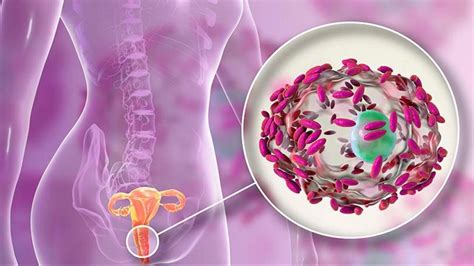 ¿qué Es La Vaginosis Bacteriana Síntomas Causas Y Cómo Tratar La