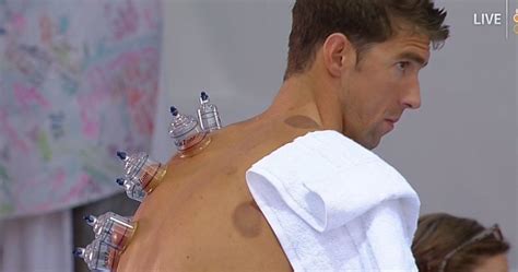 Here Finally Is The Up Close Image Of Michael Phelps Cupping Huffpost Sports